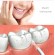 Hampaiden hoito // Hampaiden vesisuihkut // Irygator bezprzewodowy Promedix,  dentystyczny, stomatologiczny do zębów,  końcówki 2szt, kolor biały,  PR-770 W image 5
